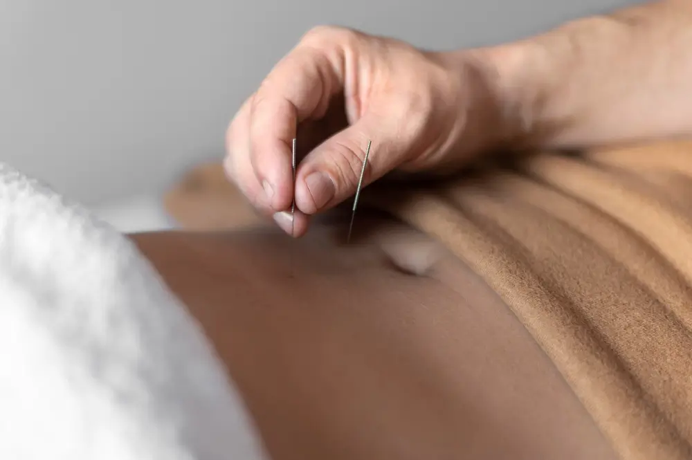 Enhancing Fertility Support with Advanced Acupuncture Care